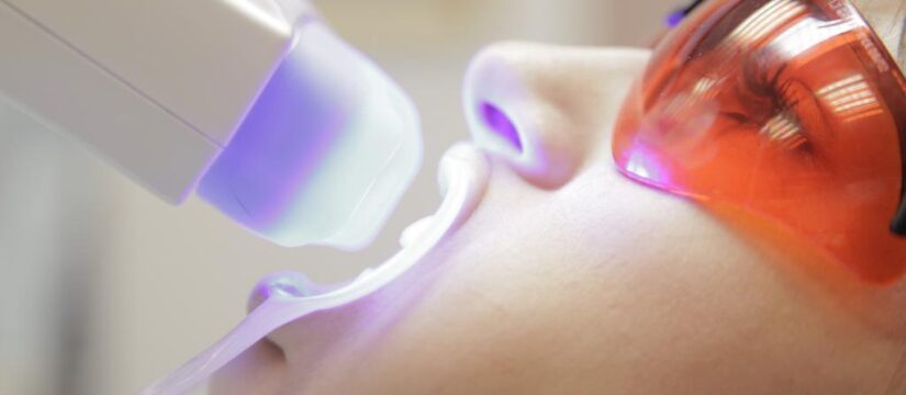 Отбеливание зубов светодиодной лампой Amazing White